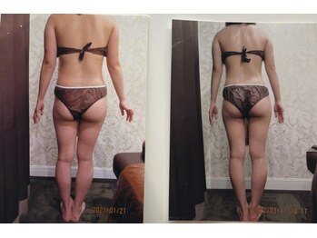 パーフェクトボディプレミアム 札幌駅前店(PERFECT BODY PREMIUM)/お客様　ビフォーアフター（12）