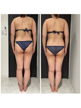 クリア(CLEAR)/リヴァイセルボディ