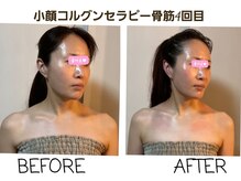 セレブリティ(Celebrity)