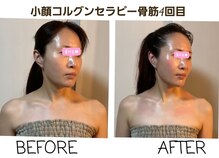 セレブリティ(Celebrity)