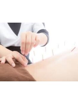 鍼灸施術を受けたい