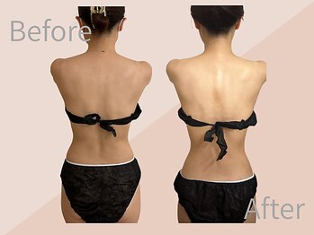 ファミーユ 名古屋店/【ブライダルケア】脂肪燃焼ケア