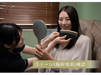 ホワイトニングショップ 武蔵小杉店/トーン(施術効果)確認