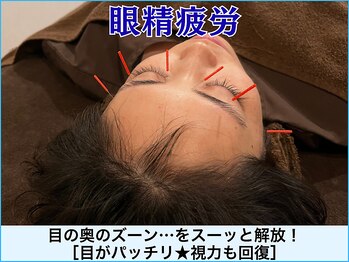 A1スポーツマッサージ治療院/【眼精疲労】肩こり・スマホ首