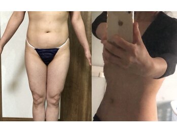 メルシー サロン(Merci Salon)/40代の体型改善!