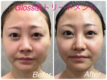 ココプラス(COCO+)