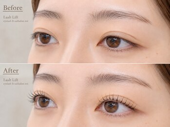 ノイ 千歳烏山店(noi)の写真/上・下まつげパーマで自然なパッチリ目元に♪エクステが苦手な方も可愛く変身!すっぴんも自信を持てる瞳へ!