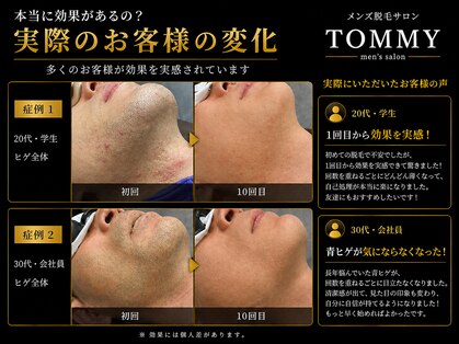 トミー(TOMMY)の写真