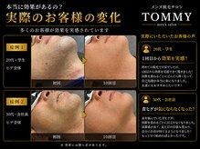 トミー(TOMMY)