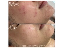 ミラリー(MIRALY)の雰囲気（深刻なお悩みもお任せください♪施術実績1万人◇症例多数）