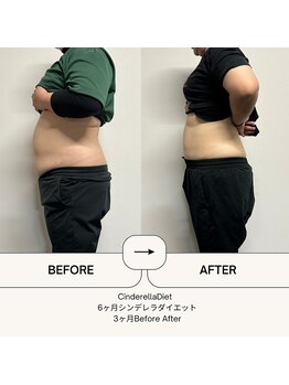 オーシャン整骨院(OCEAN整骨院)/６ヶ月コース