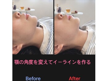 美容矯正サロン レレポノ(LELEPONO)/