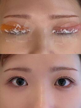 ガーデン(Garden)/左右差の調整