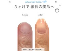 アクア(AKuA)/地爪育成ネイルケア★体験