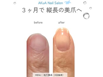 アクア(AKuA)/地爪育成ネイルケア★体験