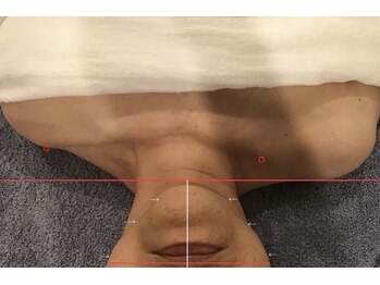 ハイナ 恵比寿店(Hi-Na)/恵比寿/フェイシャル/ブライダル