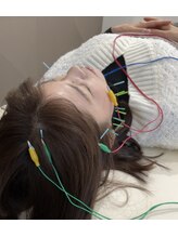 ザワ鍼灸接骨院(zawa鍼灸接骨院)/美容鍼