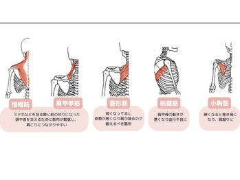 木村鍼灸整体院/肩こり、姿勢改善
