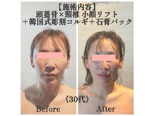 マルウル(maluulu)の雰囲気（たった1回で見違える印象へ！生まれ変わったような別人級小顔に）