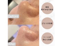 リンダ 西宮店(LINDA)の雰囲気（肌質改善&肌を土台から育てるサロン♪）