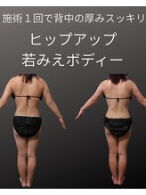 フロレゾン(Floraison)/夏痩せしませんか