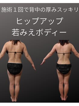 フロレゾン(Floraison)/夏痩せしませんか