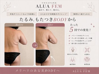 ヨサパーク アルア フェム(YOSA PARK ALUA FEM)/水素吸入!短期集中ダイエット!