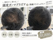 ライリー(Rairy)の雰囲気（頭皮のお悩みには次世代ダーマ）