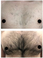 エリクサー 熊谷店(Elixir)/1回でかなり変化します