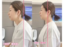 ボディステップ(BODY STEP)の雰囲気（30代/女性/ストレートネック/頭痛/原因/首歪み/肩甲骨過緊張 ）