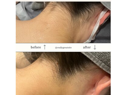リアン(Lien)の写真