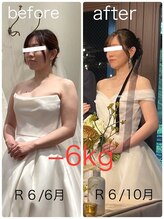 ハッチー(Hacchi)/【30代】ブライダル痩身！