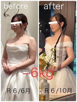 ハッチー(Hacchi)/【30代】ブライダル痩身！