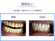 エクシアホワイトニング 岡崎店/Google★5!エリアNo.1の口コミ数