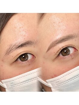 チルアンドアイ 千葉駅前店(Chill&Eye)/美眉スタイリング/BeforeAfter