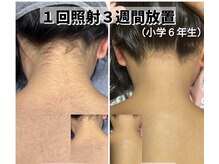 ルミエール(Lumiere)/パーツメニューもご用意あり