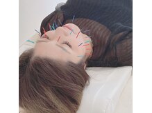 柚香鍼灸院