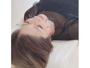 柚香鍼灸院