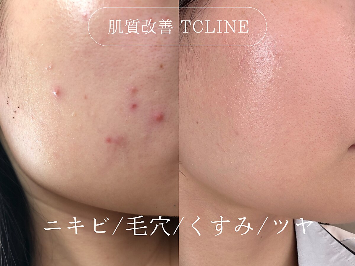 トップスキン 表参道(TOPSKIN)｜ホットペッパービューティー