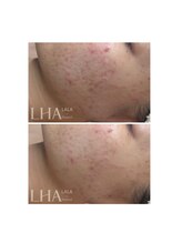 ピュアソル 奈良店(Puresol)/ララピール