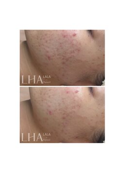 ピュアソル 奈良店(Puresol)/ララピール