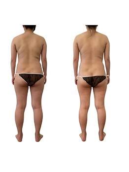 ベンザイ 梅田店(BENZAI)/体の冷え、セルライト、疲れ