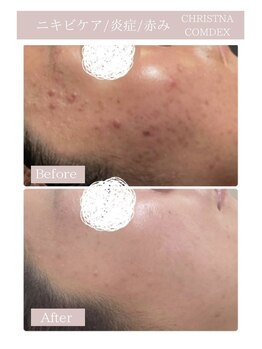 レミー(Remy)/クリスティーナ コモデックス