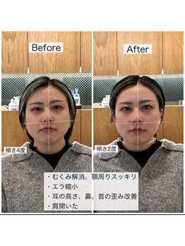 シャウルデッサン(CHARLESDESSIN)/骨格補正スパ