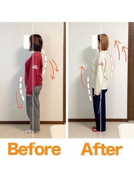 整体院ひなた 都城院/諦めていた肩こり/猫背が改善