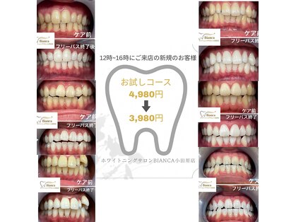 ビアンカ 小田原店(BIANCA)の写真