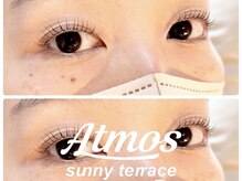 アトモス サニーテラス(Atmos sunny terrace)