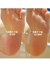 ニコプラス(NICO+)/足裏角質除去
