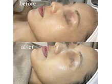 サーデ(saade)/アンストレスで土台作り