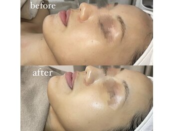 サーデ(saade)/アンストレスで土台作り